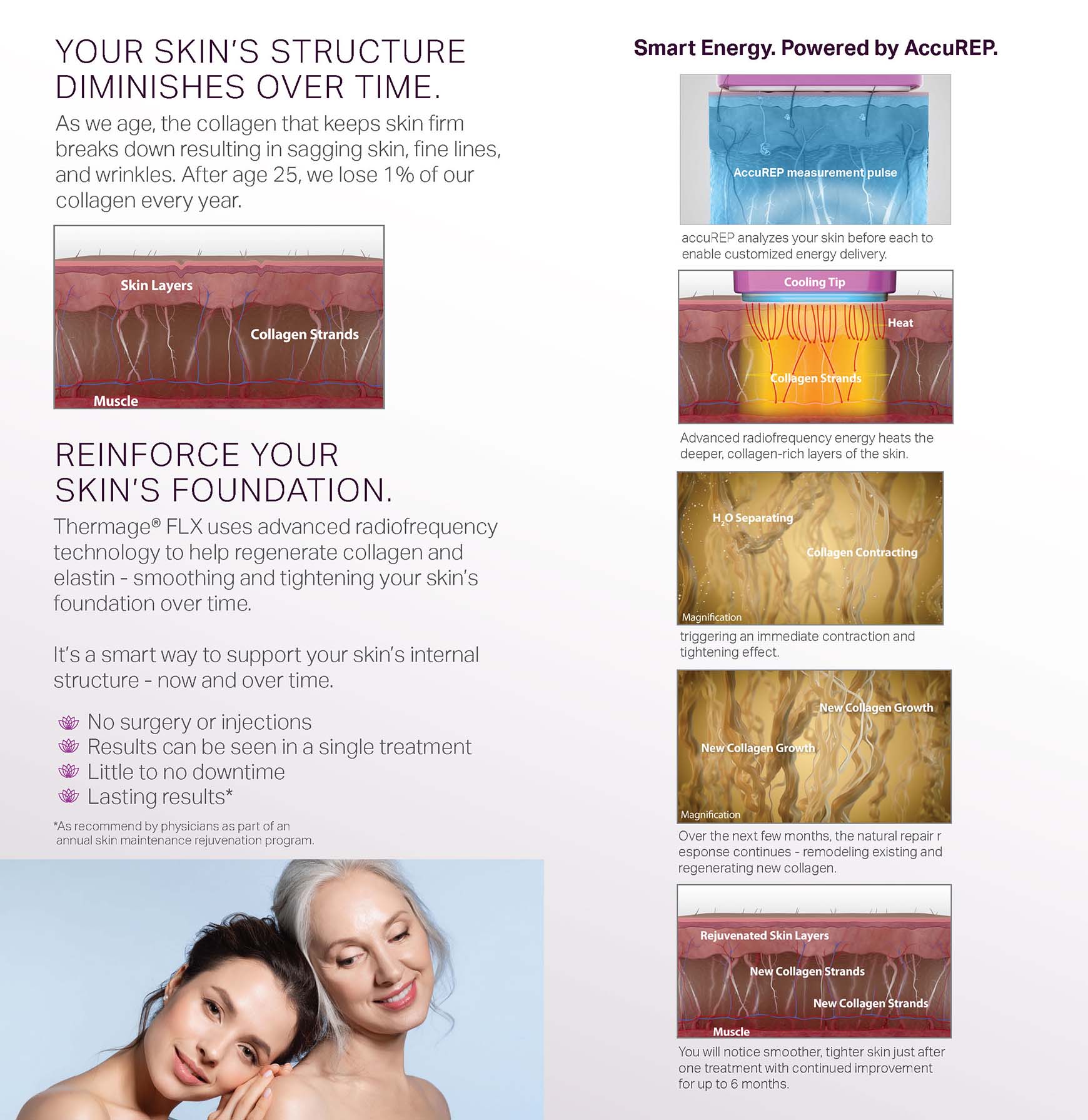 Thermage Collagen Campaign - Consumer Brochure