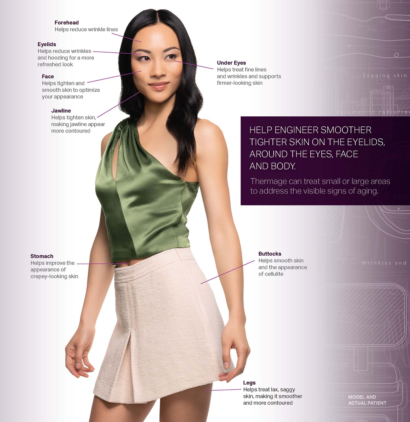 Thermage Collagen Campaign - Consumer Brochure